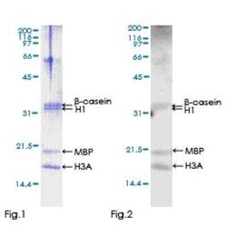 Novus Biologicals Recombinant Human NEK6 GST (N-Term) Protein 10 &mu;g | Buy Online | Novus Biologicals&trade; | Fisher Scientific
