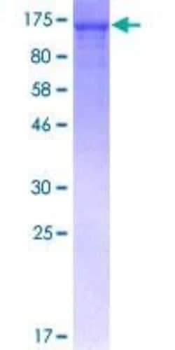 Novus Biologicals Recombinant Human NFkB p105/p50 GST (N-Term) Protein 10 &mu;g | Buy Online | Novus Biologicals&trade; | Fisher Scientific