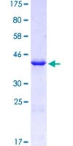 Novus Biologicals Recombinant Human NHE3/SLC9A3 GST (N-Term) Protein 10 &mu;g | Buy Online | Novus Biologicals&trade; | Fisher Scientific