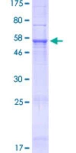 Novus Biologicals Recombinant Human NHLRC3 GST (N-Term) Protein 25 &mu;g | Buy Online | Novus Biologicals&trade; | Fisher Scientific