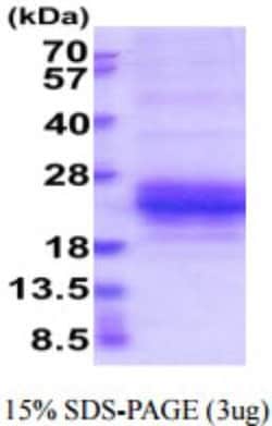 Novus Biologicals Recombinant Human NKG2A/CD159a/KLRC1 His Protein 50 &mu;g | Buy Online | Novus Biologicals&trade; | Fisher Scientific