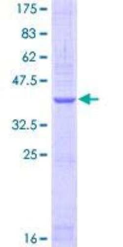 Novus Biologicals Recombinant Human NPRA/NPR1 GST (N-Term) Protein 25 &mu;g | Buy Online | Novus Biologicals&trade; | Fisher Scientific