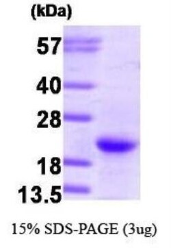Novus Biologicals&trade;&nbsp;Recombinant Human NRAS Protein