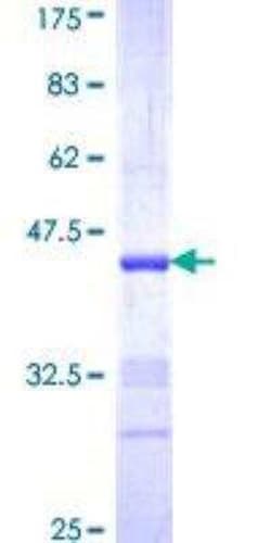 Novus Biologicals Recombinant Human Neuregulin-2 GST (N-Term) Protein 25 &mu;g | Buy Online | Novus Biologicals&trade; | Fisher Scientific