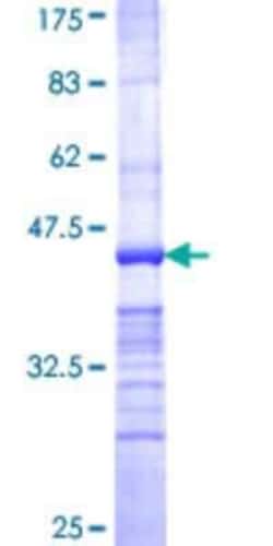 Novus Biologicals Recombinant Human OBSCN GST (N-Term) Protein 25 &mu;g | Buy Online | Novus Biologicals&trade; | Fisher Scientific