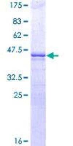 Novus Biologicals Recombinant Human OCT4 GST (N-Term) Protein 10 &mu;g | Buy Online | Novus Biologicals&trade; | Fisher Scientific