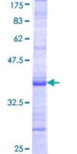 Novus Biologicals Recombinant Human OSGIN2 GST (N-Term) Protein 2 &mu;g | Buy Online | Novus Biologicals&trade; | Fisher Scientific