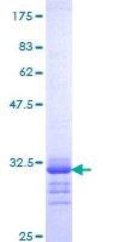 Novus Biologicals Recombinant Human Osteocalcin GST (N-Term) Protein 10 &mu;g | Buy Online | Novus Biologicals&trade; | Fisher Scientific