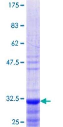 Novus Biologicals&trade;&nbsp;Recombinant Human PACAP/ADCYAP1 GST (N-Term) Protein