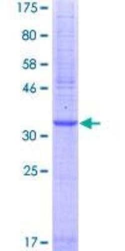 Novus Biologicals Recombinant Human PAR2 GST (N-Term) Protein 10 &mu;g | Buy Online | Novus Biologicals&trade; | Fisher Scientific