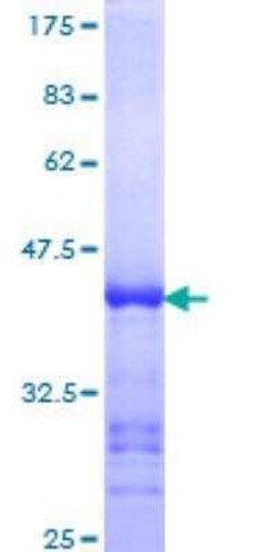 Novus Biologicals Recombinant Human PARP4 GST (N-Term) Protein 25 &mu;g | Buy Online | Novus Biologicals&trade; | Fisher Scientific