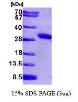 Novus Biologicals&trade;&nbsp;Recombinant Human PCMT1 His Protein