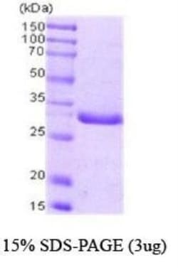Novus Biologicals Recombinant Human PCNA Protein 0,1 mg | Buy Online | Novus Biologicals&trade; | Fisher Scientific