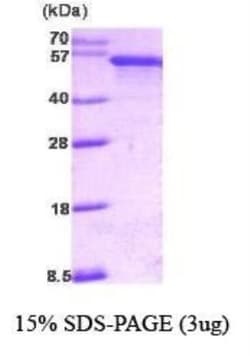 Novus Biologicals&trade;&nbsp;Recombinant Human PDCD4 Protein