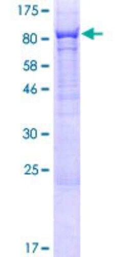 Novus Biologicals&trade;&nbsp;Recombinant Human PHF21B GST (N-Term) Protein