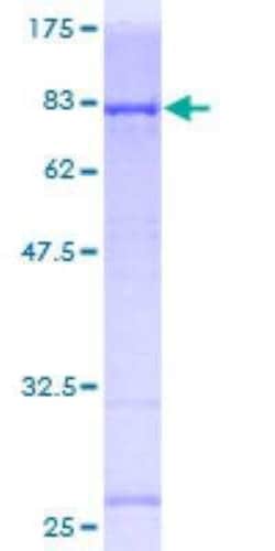 Novus Biologicals Recombinant Human PI 3-Kinase p85 alpha GST (N-Term) Protein 10 &mu;g | Buy Online | Novus Biologicals&trade; | Fisher Scientific