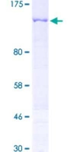 Novus Biologicals Recombinant Human PKN3 GST (N-Term) Protein 2 &mu;g | Buy Online | Novus Biologicals&trade; | Fisher Scientific