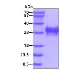 Novus Biologicals Recombinant Human PLGF His Protein 0.05 mg | Buy Online | Novus Biologicals&trade; | Fisher Scientific