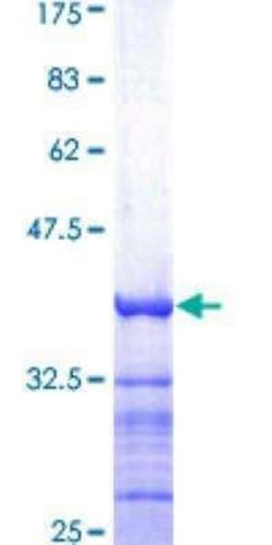 Novus Biologicals Recombinant Human PMCA1 GST (N-Term) Protein 25 &mu;g | Buy Online | Novus Biologicals&trade; | Fisher Scientific