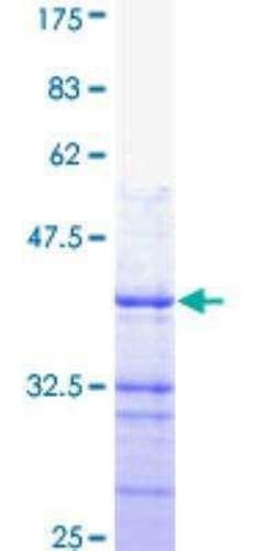 Novus Biologicals Recombinant Human PMCA4 GST (N-Term) Protein 10 &mu;g | Buy Online | Novus Biologicals&trade; | Fisher Scientific