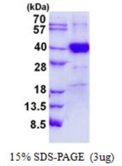 Novus Biologicals&trade;&nbsp;Recombinant Human POLR3F His Protein
