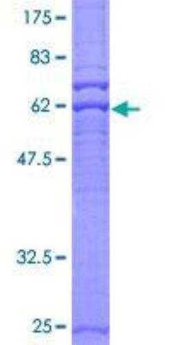 Novus Biologicals Recombinant Human PRKAG2 GST (N-Term) Protein 25 &mu;g | Buy Online | Novus Biologicals&trade; | Fisher Scientific