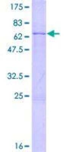 Novus Biologicals Recombinant Human PRPF8 GST (N-Term) Protein 2 &mu;g | Buy Online | Novus Biologicals&trade; | Fisher Scientific