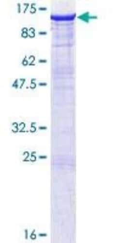 Novus Biologicals Recombinant Human PSD-95 GST (N-Term) Protein 10 &mu;g | Buy Online | Novus Biologicals&trade; | Fisher Scientific