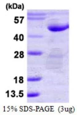 Novus Biologicals Recombinant Human PTPN7 His Protein 50 &mu;g | Buy Online | Novus Biologicals&trade; | Fisher Scientific