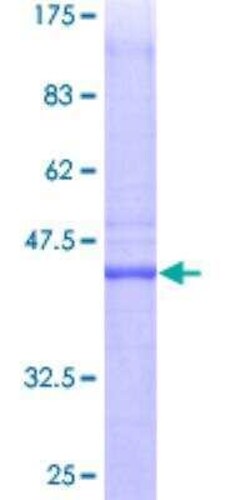 Novus Biologicals Recombinant Human PTTG1IP GST (N-Term) Protein 25 &mu;g | Buy Online | Novus Biologicals&trade; | Fisher Scientific