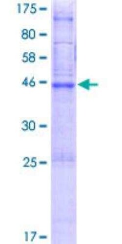 Novus Biologicals Recombinant Human PTTG1IP GST (N-Term) Protein 2 &mu;g | Buy Online | Novus Biologicals&trade; | Fisher Scientific