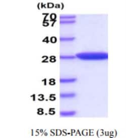 Novus Biologicals Recombinant Human Park7/DJ-1 His Protein 0.1 mg | Buy Online | Novus Biologicals&trade; | Fisher Scientific