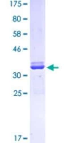 Novus Biologicals Recombinant Human Pax7 GST (N-Term) Protein 10 &mu;g | Buy Online | Novus Biologicals&trade; | Fisher Scientific
