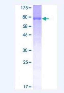 Novus Biologicals Recombinant Human Peripherin GST (N-Term) Protein 25 &mu;g | Buy Online | Novus Biologicals&trade; | Fisher Scientific