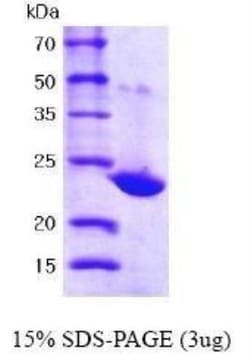 Novus Biologicals Recombinant Human Peroxiredoxin 1 His Protein 0.1 mg | Buy Online | Novus Biologicals&trade; | Fisher Scientific