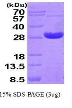 Novus Biologicals&trade;&nbsp;Recombinant Human Peroxiredoxin 4 His Protein