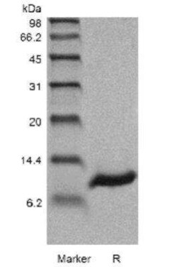 Novus Biologicals Recombinant Human Persephin Protein 5 &mu;g | Buy Online | Novus Biologicals&trade; | Fisher Scientific