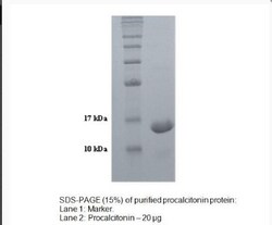Novus Biologicals Human Procalcitonin Protein 0.01mg; Unlabeled | Buy Online | Novus Biologicals&trade; | Fisher Scientific