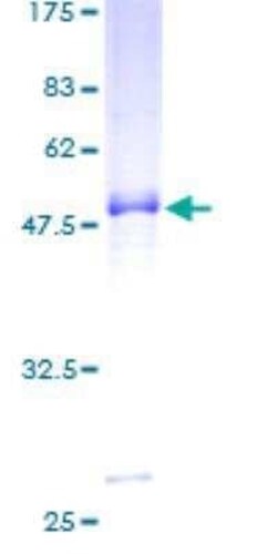 Novus Biologicals Recombinant Human Proprotein convertase PC4 GST (N-Term) Protein 25 &mu;g | Buy Online | Novus Biologicals&trade; | Fisher Scientific