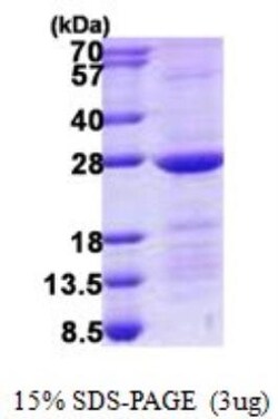 Novus Biologicals&trade;&nbsp;Recombinant Human RAB10 His Protein