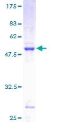Novus Biologicals Recombinant Human RAB7L1 GST (N-Term) Protein 10 &mu;g | Buy Online | Novus Biologicals&trade; | Fisher Scientific