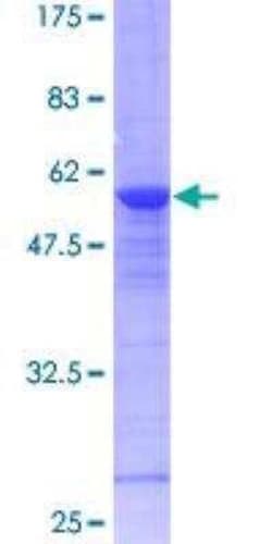 Novus Biologicals&trade;&nbsp;Recombinant Human RAB8A GST (N-Term) Protein