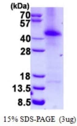 Novus Biologicals&trade;&nbsp;Recombinant Human RAP30 His Protein