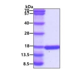 Novus Biologicals Recombinant Human RAR alpha/NR1B1 His Protein 100 &mu;g | Buy Online | Novus Biologicals&trade; | Fisher Scientific