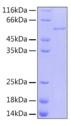 Novus Biologicals Recombinant Human RBBP4/RbAp48 Protein 50 &mu;g | Buy Online | Novus Biologicals&trade; | Fisher Scientific