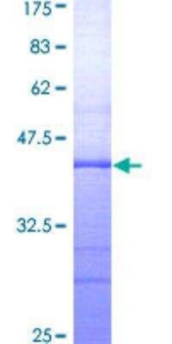 Novus Biologicals Recombinant Human RED1 GST (N-Term) Protein 25 &mu;g | Buy Online | Novus Biologicals&trade; | Fisher Scientific