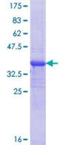 Novus Biologicals Recombinant Human RERE GST (N-Term) Protein 10 &mu;g | Buy Online | Novus Biologicals&trade; | Fisher Scientific