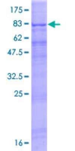 Novus Biologicals Recombinant Human RGS22 GST (N-Term) Protein 25 &mu;g | Buy Online | Novus Biologicals&trade; | Fisher Scientific