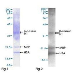 Novus Biologicals Recombinant Human RIPK3/RIP3 GST (N-Term) Protein 25 &mu;g | Buy Online | Novus Biologicals&trade; | Fisher Scientific