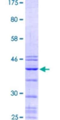 Novus Biologicals Recombinant Human RNA polymerase I termination factor GST (N-Term) Protein 10 &mu;g | Buy Online | Novus Biologicals&trade; | Fisher Scientific